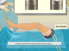 Virtual Knee Surgery cover